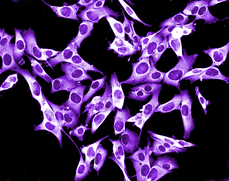 melanoma cell line